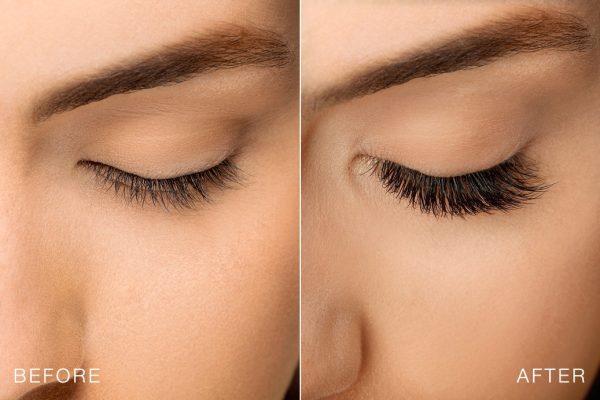 Eyelast Extension